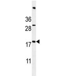 ACN9 antibody western blot analysis in mouse bladder tissue lysate. Predicted molecular weight ~15 kDa.~