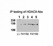 HDAC9 antibody NSJ# F41192 and <a href=../tds/hdac9-antibody-f41193>NSJ# F41193</a> can both immunoprecipitate the protein from HeLa-HDAC9 tranfected cells. (Data kindly provided by Dr. Zhigang Yuan, H. Lee Moffitt Cancer Center and Research Institute)