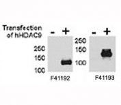 HDAC9 antibody NSJ# F41192 and <a href=../tds/hdac9-antibody-f41193>NSJ# F41193</a> were tested by WB and IP-WB using HeLa and HeLa-HDAC9 transfected cells. Both antibodies detect the protein in transfected cells but not non-transfected.