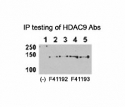 HDAC9 antibody <a href=../tds/hdac9-antibody-f41192>NSJ# F41192</a> and NSJ# F41193 can both immunoprecipitate the protein from HeLa-HDAC9 tranfected cells. (Data kindly provided by Dr. Zhigang Yuan, H. Lee Moffitt Cancer Center and Research Institute)