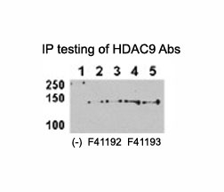 HDAC9 antibody <a href=../tds/hdac9-antibody-f41192>NSJ# F41192</a> and NSJ# F41193 can both immunoprecipitate the protein from HeLa-HDAC9 tranfected cells. (Data kindly provided by Dr. Zhigang Yuan, H. Lee Moffitt Cancer Center and Research Institute)