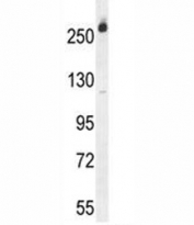CAD antibody western blot analysis in Jurkat lysate. Predicted molecular weight ~243 kDa.