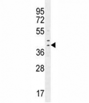 IRF1 antibody western blot analysis in human MDA-MB-231 cell lysate. Expected molecular weight: ~37 kDa (unmodified), 45-50 kDa (modified).