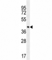 FOXA2 antibody western blot analysis in MDA-MB231 lysate. Predicted molecular weight: 50 kDa.