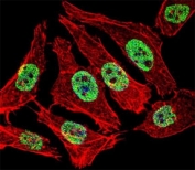 Fluorescent confocal image of A549 cell stained with FOXA2 antibody at 1:25. FOXA2 immunoreactivity is localized to the nucleus.