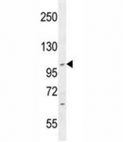 IFT88 antibody western blot analysis in CEM lysate. Predicted molecular weight ~94 kDa.