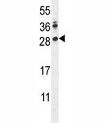 LIN28A antibody western blot analysis in mouse Neuro-2a lysate. Predicted molecular weight ~23 kDa.
