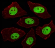 Immunofluorescent analysis of A549 cells using LIN28A antibody at 1:100. Alexa Fluor 488-conjugated secondary was used (green). Cytoplasmic actin was counterstained with Dylight Fluor 554 conjugated Phalloidin (red).