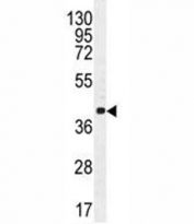 Cyclin C antibody western blot analysis in NCI-H460 lysate. Predicted molecular weight: 33-37 kDa