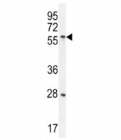 DLK antibody western blot analysis in CEM lysate. Observed molecular weight 41~60 kDa depending on glycosylation level.