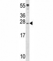 IGF2 antibody western blot analysis in mouse cerebellum tissue lysate. Predicted molecular weight: 20, 20, 26 kDa (isoforms 1-3).