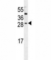IGF2 antibody western blot analysis in HeLa lysate. Predicted molecular weight: 20, 20, 26 kDa (isoforms 1-3).