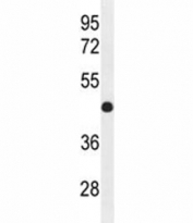 IRF2 antibody western blot analysis in mouse bladder tissue lysate. Estimated molecular weight: ~39kDa but routinely observed at 39-50kDa.