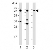 Western blot testing of 1) human SH-SY5Y, 2) mouse adrenal gland and 3) rat adrenal gland lysate with DBH antibody. Predicted molecular weight ~69 kDa.