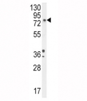 DBH antibody western blot analysis in A2058 lysate. Predicted molecular weight ~69 kDa.