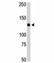 JAK2 antibody used in western blot to detect JAK2 in mouse thymus tissue lysate. Predicted molecular weight ~130 kDa