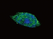 Confocal immunofluorescent analysis of JAK2 antibody with HeLa cells followed by Alexa Fluor 488-conjugated goat anti-rabbit lgG (green). DAPI was used as a nuclear counterstain (blue).