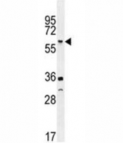 TNFR antibody western blot analysis in U251 lysate. Predicted molecular weight ~51kDa.