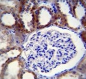 Caspase-3 antibody immunohistochemistry analysis in formalin fixed and paraffin embedded human kidney tissue.