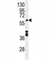 CYP1A2 antibody western blot analysis in mouse liver tissue lysate. Predicted molecular weight ~58 kDa.