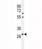 PHOX2B antibody western blot analysis in mouse liver tissue lysate