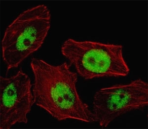 Fluorescent image of U251 cell stained with PHOX2B antibody. Alexa Fluor 488 conjugated secondary (green) was used. Cytoplasmic actin was counterstained with Alexa Fluor 555 (red) conjugated Phalloidin. PHOX2B immunoreactivity is localized to the nucleus.~