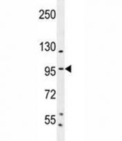 SP1 antibody western blot analysis in K562 lysate. Reported molecular weight: 81-95 kDa