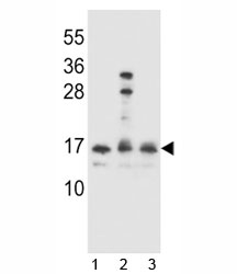 HOPX antibody western blot analysis in 1) Ramos, 2) A2058 and 3) 293 lysate.~