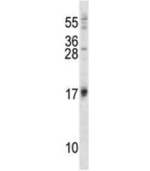 ISG15 antibody western blot analysis in 293 lysate