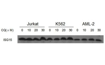 ISG15 antibody western blot analysis in Jurkat, K562 and AML-2 lysate treated with CQ (0/10/20/30uM) for 24 hours. (Courtesy of Biyin Cao, Soochow University, Center for Blood Research)