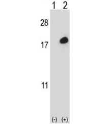 Western blot analysis of ISG15 antibody and 293 cell lysate (2 ug/lane) either nontransfected (Lane 1) or transiently transfected (2) with the ISG15 gene.