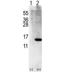 Western blot analysis of ISG15 antibody and 293 cell lysate (2 ug/lane) either nontransfected (Lane 1) or transiently transfected with ISG15 gene (2).