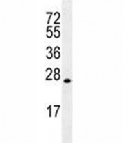 LIN28 antibody western blot analysis in MDA-MB435 lysate. Predicted molecular weight ~23 kDa.