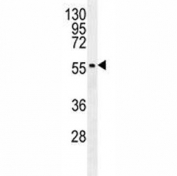 MITF antibody western blot analysis in K562 lysate. Predicted molecular weight: 55-60 kDa.