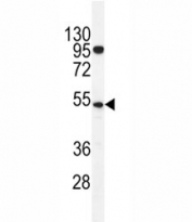 TdT antibody western blot analysis in K562 lysate. Predicted molecular weight ~55 kDa