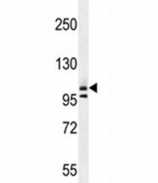 COL1A2 antibody western blot analysis in T47D lysate