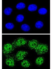 Confocal immunofluorescent analysis of MSH2 antibody with HeLa cells followed by Alexa Fluor 488-conjugated goat anti-rabbit lgG (green). DAPI was used as a nuclear counterstain (blue).