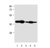 Western blot testing of human 1) MOLT-4, 2) Jurkat, 3) HeLa, 4) HL-60 and 5) DU145 cell lysate with ADA antibody. Expected molecular weight ~41 kDa.