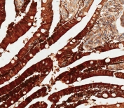 IHC testing of FFPE human duodenum tissue with ADA antibody. HIER: steam section in pH6 citrate buffer for 20 min and allow to cool prior to staining.