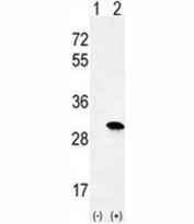 Western blot analysis of H-RAS antibody and 293 cell lysate either nontransfected (Lane 1) or transiently transfected (2) with the HRAS gene.