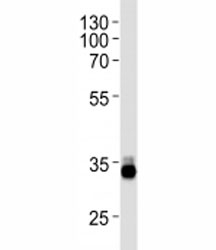OTX2 antibody western blot analysis in Y79 lysate~