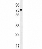 MLH1 antibody western blot analysis in K562 lysate. Predicted molecular weight: 85/58/74 kDa (isoforms 1/2/3).