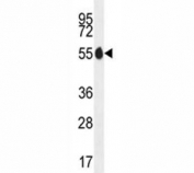 PAX1 antibody western blot analysis in MDA-MB435 lysate. Predicted size 45~55 kDa