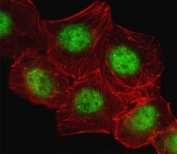 Fluorescent image of A549 cell stained with CREB antibody. Alexa Fluor 488 (green) secondary was used (1:400, 50 min at 37oC). Cytoplasmic actin was counterstained with Alexa Fluor 555 (red) conjugated Phalloidin. Immunoreactivity is localized to the nucleus.