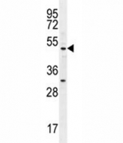 MEF2D antibody western blot analysis in ZR-75-1 lysate.