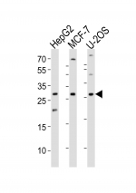 Western blot analysis of lysate from HepG2, MCF-7, U-2OS cell line (left to right) using ID1 antibody; Ab was diluted at 1:1000 for each lane.