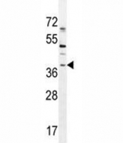 SOX1 antibody western blot analysis in NCI-H460 lysate.
