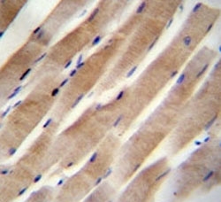RHEB antibody immunohistochemistry analysis in formalin fixed and paraffin embedded human skeletal muscle.~