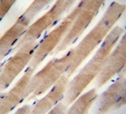 RHEB antibody immunohsitochemistry analysis in formalin fixed and paraffin embedded human skeletal muscle.