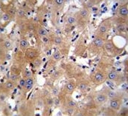 TRPM8 antibody immunohistochemistry analysis in formalin fixed and paraffin embedded human liver tissue.